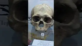 Черепа древних воинов со следами ранений