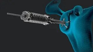 VIP™ Vision: Episode 4—Introducing the New VIP Depth of Ream Instrumentation