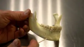 SKELETAL SYSTEM ANATOMY: Mandible