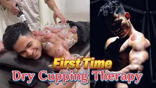 My First Time Dry Cupping Therapy | Full Body Detox Formula Age 18