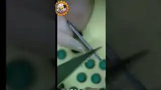 📌อาการค้างโลโก้💢