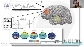 Monitoreo de la Actividad Eléctrica Cerebral ¿SEDLINE mi mejor opción?
