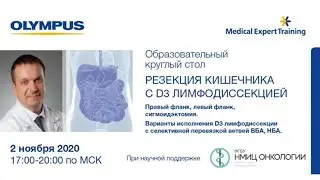 Резекция кишечника с D3 лимфодиссекцией. Карачун А.М.