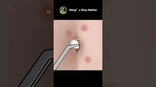 How DIRTY could a belly button be?! ASMR Belly Button Cleaning Animation