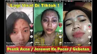 Cara Mendapatkan Filter Jerawat Di Instagram