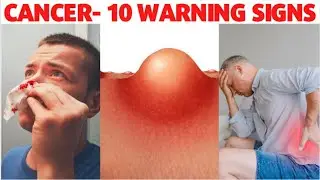 Don't Ignore: 10 Common Warning Signs that You Have Cancer