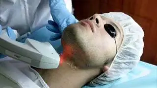 Depilacion Masculina Laser IPL Definitiva Medellin tel 5865705