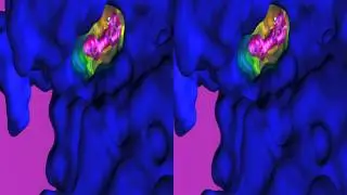 [3D] Mechanism of Iressa Drug Resistance