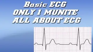 ECG Basic||ইসিজি বেসিক নলেজ