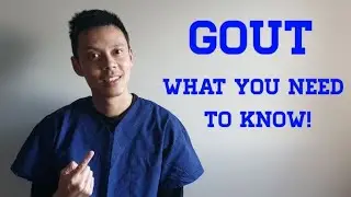 How To Treat Gout - Comprehensive Guide (Symptoms, Complications, Treatment)
