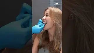 Стоматолог в шоке😂 