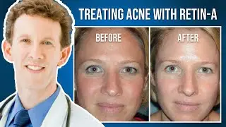 How Does Retin-A (Tretinoin) Improve the Skin?