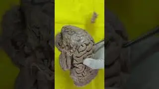 Identification of Brain in Exam | viva questions |