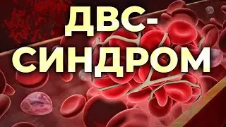 ДВС-синдром. Синдром диссеминированного внутрисосудистого свёртывания (коагулопатия потребления).