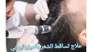 Hair mesotherapy علاج تساقط الشعر بتقنية الميزوثيرابي