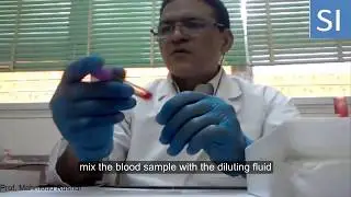 Practical guide for counting of blood platelets !!!