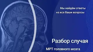 MRI of the brain