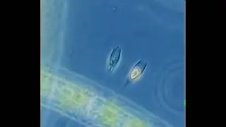 Dinobryon utriculus