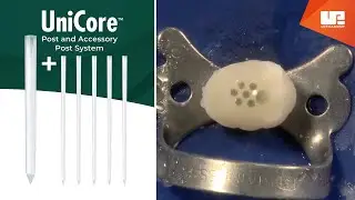 UniCore™ posts master and accessory