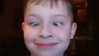 МОЕ ЛИЦО РАЗОРВАЛО!!!