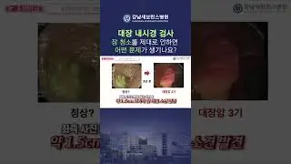 대장내시경 전에 장 정결을 제대로 안 하면 어떻게 될까? #대장내시경
