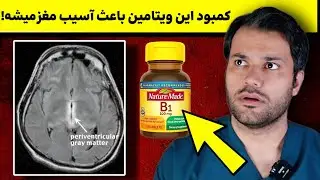 10 علامت کمبود ویتامین B1 که باید بدونید ❌️ کمبودش باعث آسیب به مغز میشه!