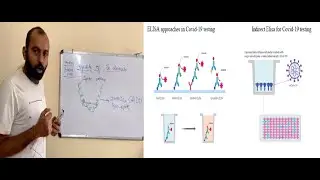 #Radio Immuno Assay In Covid 19 Detection#Immuno Assay #Immunoinformatics# Immunology of Covid-19#