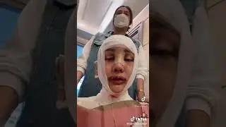 Lucinta luna operasi rahang dan suara #lucintaluna #shorts