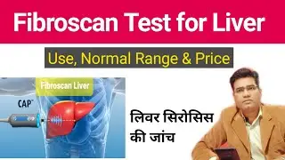 What is Fibroscan Test for Liver - Explained in Hindi | Use, Price and  Normal Range