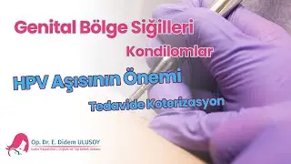 Genital bölge siğilleri, kondilomlar. Hpv aşısının önemi. Tedavide koterizasyon