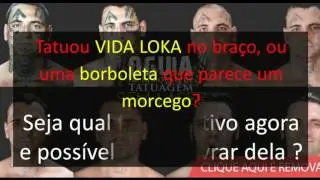 Saiba como remover qualquer tatuagem naturalmente   Saiba Como