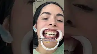 GUM TRIM 
