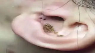 WOW KOMEDO BESAR DI TELINGA!!!!