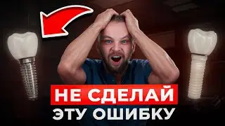 Титан vs Цирконий: какой имплант на самом деле лучше?