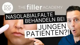 Warum junge Patienten von der BEHANDLUNG der NASOLABIALFALTEN profitieren! TFA by doc.rolf