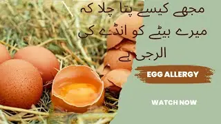My 1 years old son has egg allergy/ when and how i found he has egg allergy