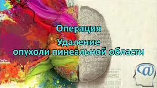 Операция. Удаление опухоли пинеальной области головного мозга. Pineal tumor removal operation
