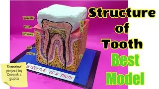 Structure of tooth model #tooth #thermocol #toothcare #biologymodel #dentalcare #dentist #teeth #tlm