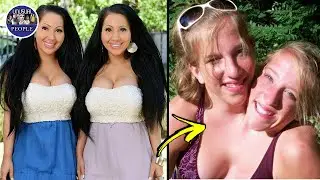 UNUSUAL TWINS YOU WON'T BELIEVE EXIST #3