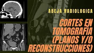 ✂️🧍🏻‍♂️ Cortes en tomografía (planos y/o reconstrucciones) ✂️🧍🏻‍♂️