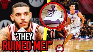 Exposing The *Truth* Behind Lonzo Ball’s Injury