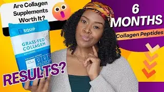 I Tried Collagen Peptides for 6 MONTHS! DID IT WORK? #collagen
