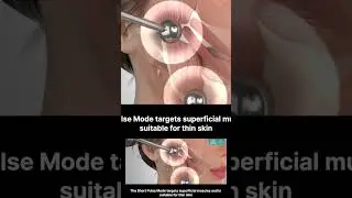 EVE Facial 15: EMS #4