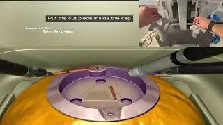 4th arm cutting: Robot100% DaVinci surgery series