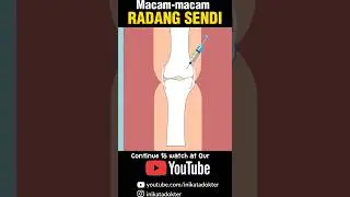 Macam-Macam Radang Sendi