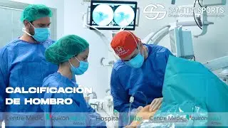 CALCIFICACIONES DE HOMBRO (Calcifying tendinitis)