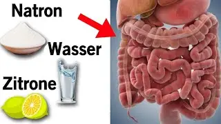 Das passiert wenn du Zitrone, Natron und Wasser für eine Kur einnimmst!