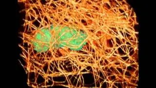 Cancer-cell squeeze | Science News