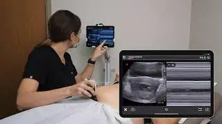 Viabilidade Fetal - USG Ultra Portátil p/ Ginecologistas e Obstetras