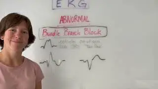 EKG: Bundle Branch Block: Race cars